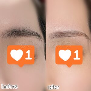 ワックス脱毛のビフォーアフター写真